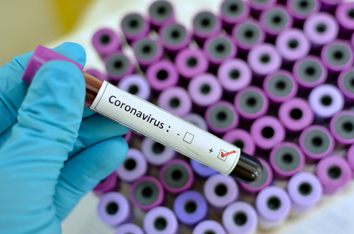 Positive coronavirus test